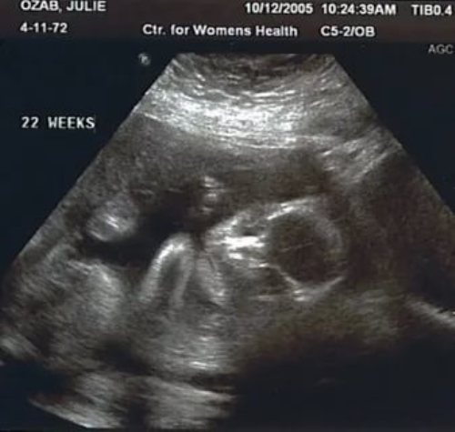 Беременность 22 недели