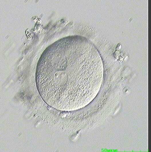 Качество эмбрионов для переноса