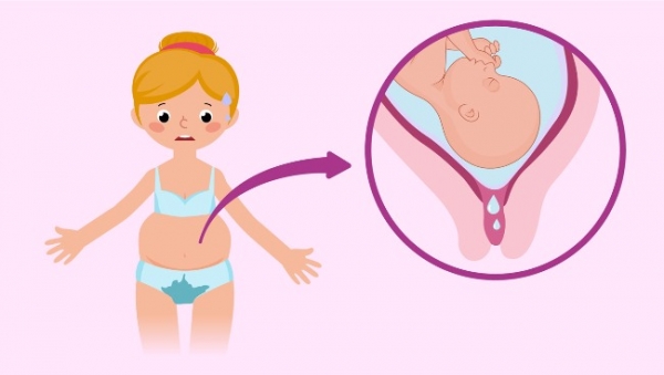 Как отходят воды при беременности