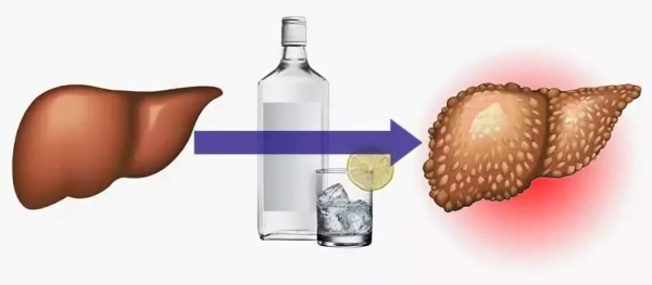 Панкреатит и алкоголь: какое спиртное можно пить, последствия