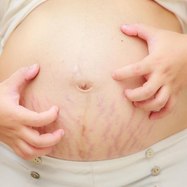 Почему чешется живот и все тело при беременности